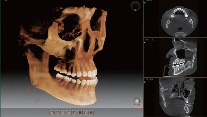3D Imaging showing full jaw